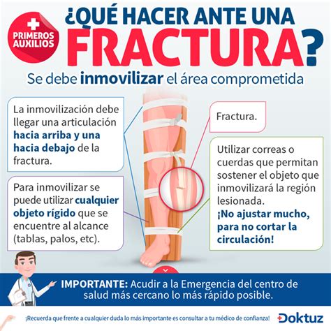 Qué hacer ante una fractura https doktuz wikidoks prevencion