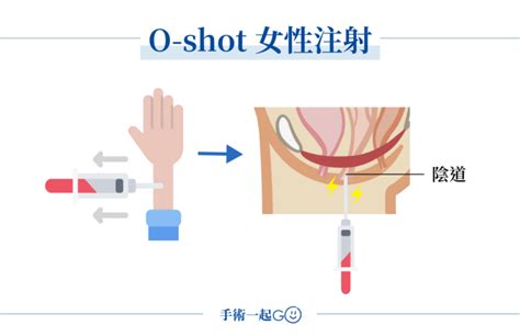 漏尿怎麼辦？了解男女漏尿原因與治療方法，揮別漏尿困擾！ 手術一起go