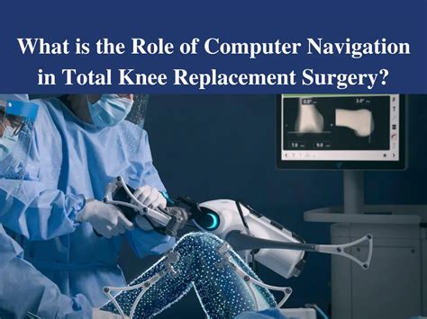 Role Of Computer Navigation In Total Knee Replacement Surgery