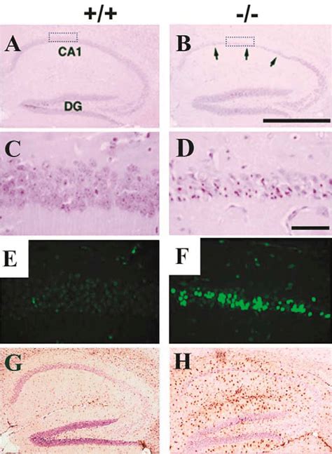 Histological and immunohistochemical analysis of the hippocampus of ... 