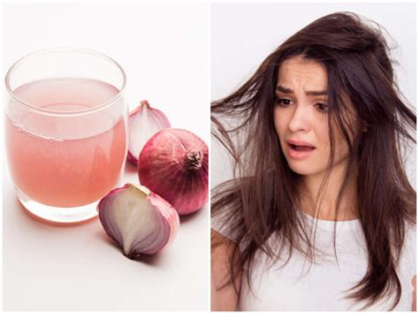 Heres How You Can Reverse Hair Fall With Onion Juice