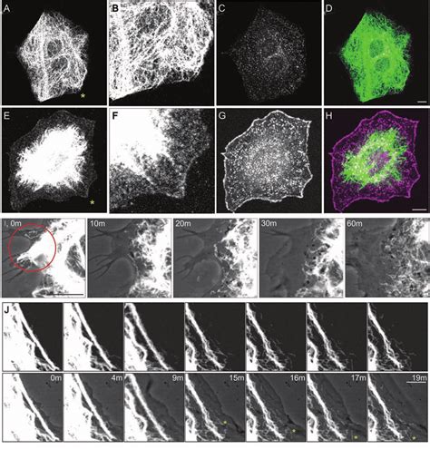 PA-Rac1 activation induces vimentin reorganization. (A-D) Double-label ...