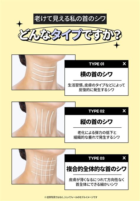 首は年齢を隠せない？タイプ別首のシワケアで改善【jfeelクリニック】 Jfeelclinic【ジェイフィールクリニック】