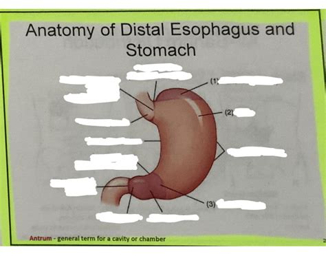 Distal eso and stomach Quiz