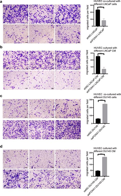 Foxa1 Expression In Prostate Cancer Cells Enhanced The Migration Of