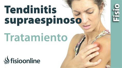 Tendinitis Del Supraespinoso Tratamiento Con Ejercicios Automasajes