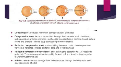 Ocular Trauma Classification Of Mechanical Injuries Clinical Featu