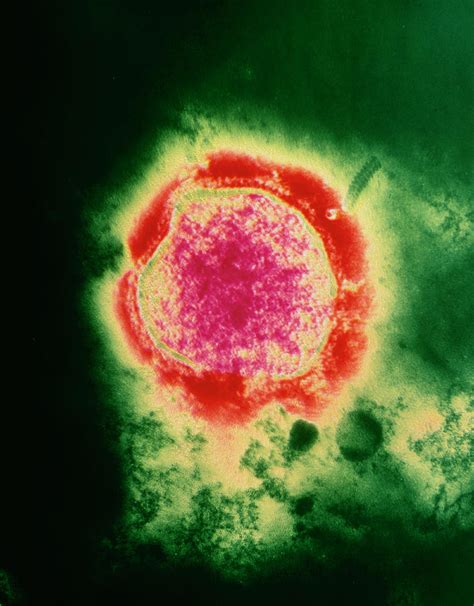 Coloured Tem Of The Measles Virus Photograph By Nibsc Science Photo Library