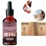 Buy Groovy Present Repair Stretch Marks Removal Cream Natural Heal