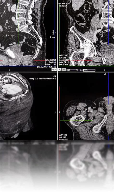 Teleradiologia Zdalne Opisy Bada Radiologicznych