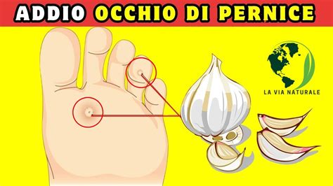 Occhio Di Pernice Come Si Toglie Con Rimedi Naturali Casalinghi Callo