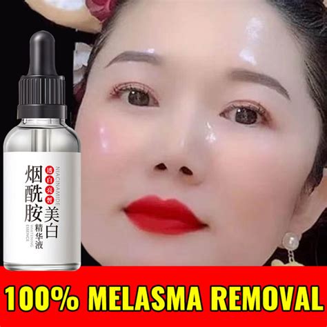 Whitening Freckle Serum Remove Freckles And Mole Original Japanese