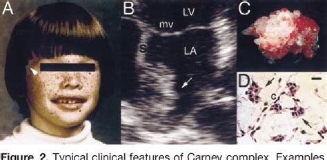 Neurothekeoma Semantic Scholar