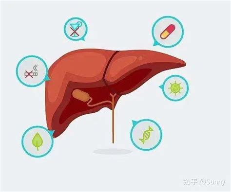 体检提醒 肝癌的诊断尤其是微小肝癌 知乎