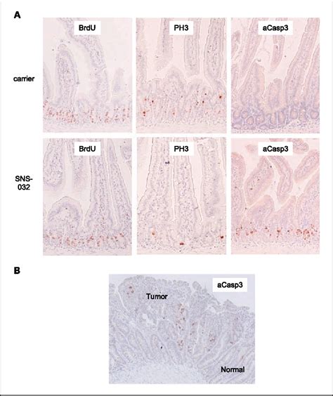 Figure From Chemoprevention Of Mouse Intestinal Tumorigenesis By The