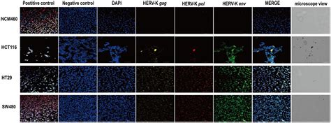 Frontiers Identification Of Differentially Expressed Herv K Hml