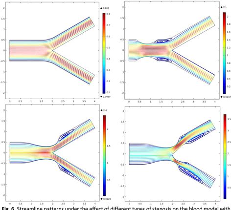 Figure 6 From Effect Of Different Types Of Stenosis On Generalized