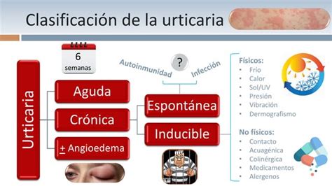 Urticaria Crónica En Niños Prof Dr Ortega Martell Ppt Descarga