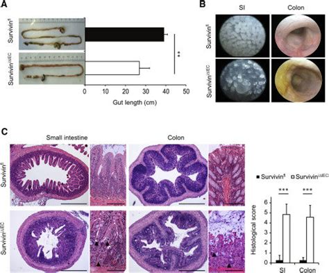 Deletion Of Survivin In The Intestinal Epithelium Leads To Disruption