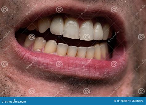 Young Man With Open Mouth Showing Teeth Stock Image Image Of Macro