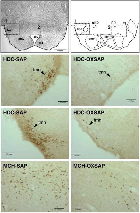 Representative Examples Of Immunostaining For Histidine Decarboxylase