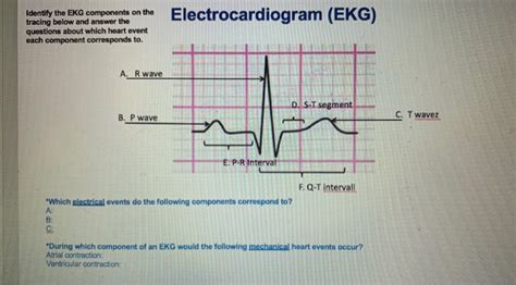 Solved Electrocardiogram Ekg Identify The Ekg Components Chegg