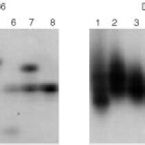 Dna Fingerprinting Analysis Of Biliary Tract Cancer Cell Lines Using