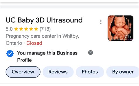 4d pregnancy ultrasound by UC Baby 3D Ultrasound in Whitby, ON - Alignable