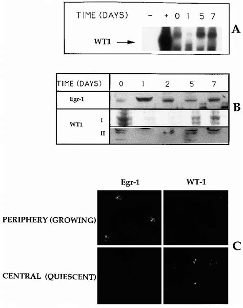 Detection Of Wt1 Gene Expression In Cultured Llc Pk 1 Cells A