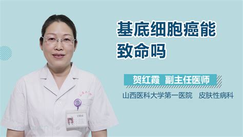 基底细胞癌致命吗 有来医生