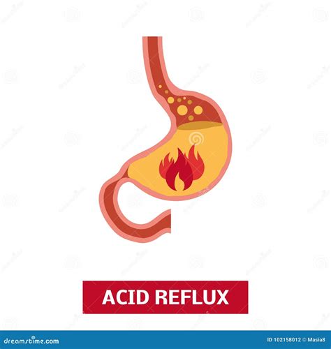 Acid Reflux Icons Stock Illustration Illustration Of Care