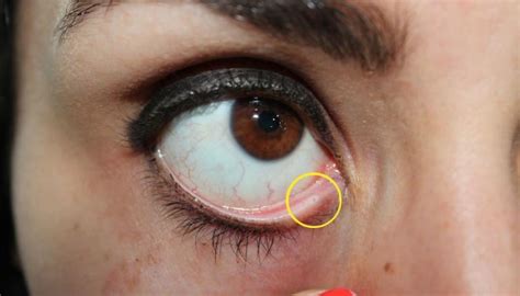 Por qué tenemos un agujero dentro del ojo No es la salida de las