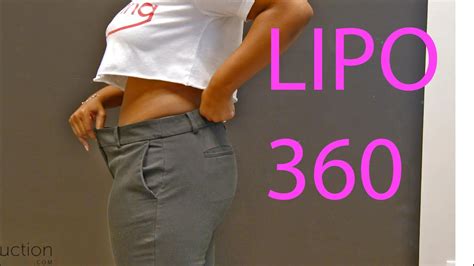 Lipo 360 Patient Atlanta Liposuction Robin Youtube