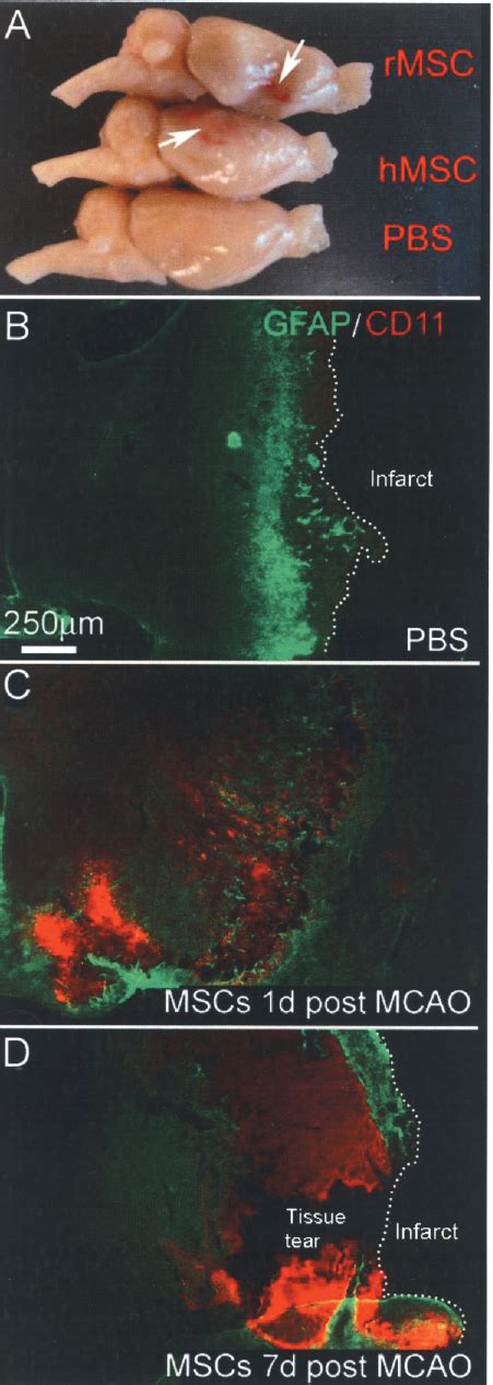 gross  histological examination   brain  mcao rats  msc