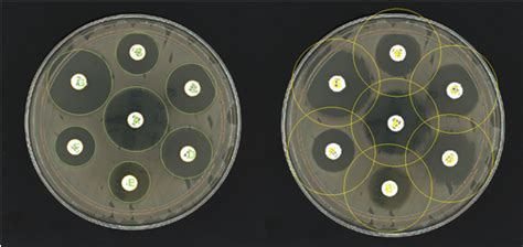 Antibiotic Susceptibility Testing Ast Synbiosis