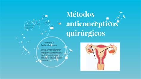 Métodos Anticonceptivos Quirúrgicos By Eduardo Tapia Villegas On Prezi