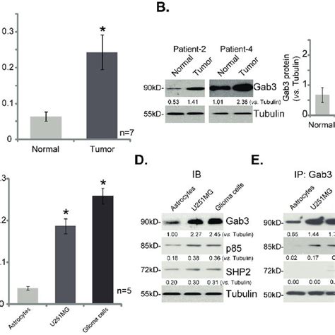 Gab3 Overexpression In Human Glioma Tissues And Glioma Cells Gab3 Mrna