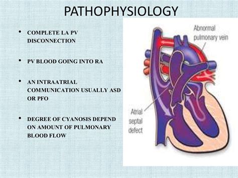 TAPVC A CASE STUDY