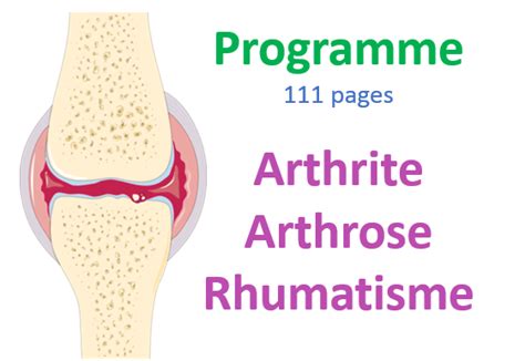 Soulager Larthrite Larthrose Et Les Rhumatismes©