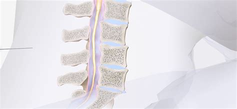 Lumbar Puncture 3d Model Leukemia And Lymphoma Society