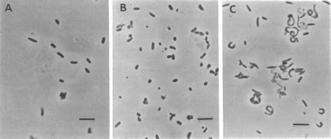 Phase Contrast Photomicrographs Showing The Morphology Of E Coli Cells Download Scientific