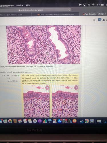 QCM Physio Cartes Quizlet