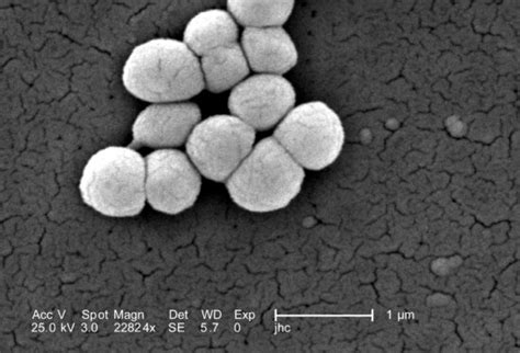 Free Picture Magnification 12230x Morphologic Gram Positive