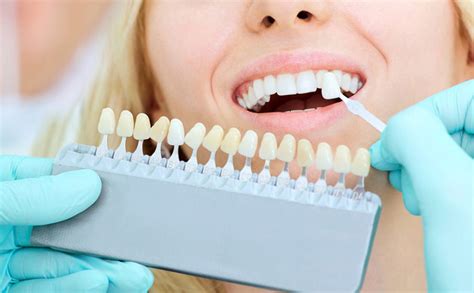 Lucir Una Sonrisa Saludable Con Un Blanqueamiento Dental