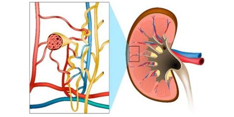 Understanding Glomerulonephritis: Causes, Symptoms, And Diagnosis - SKI