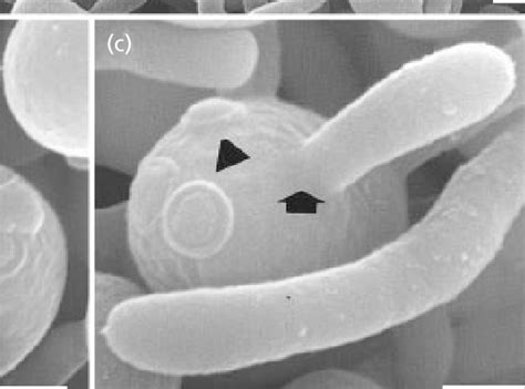 A C Scanning Electron Micrographs Of Germ Tube Emission In C