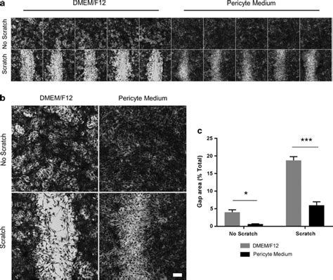 Culture Media Modifies Pericyte Migration Following A Scratch Wound