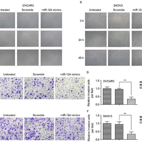 Overexpression Of Mir Suppressed Ovarian Cancer Cell Migration And