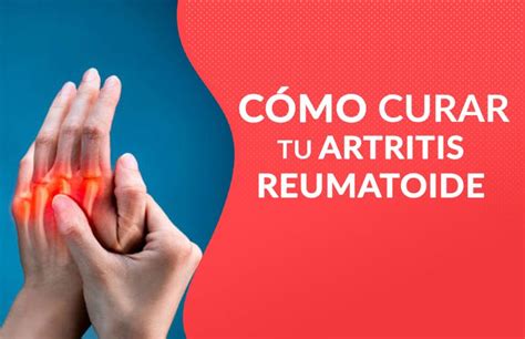 ¿cómo Curar Tu Artritis Reumatoide Nuevas Evas