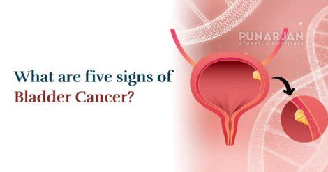 5 Early Warning Signs Of Bladder Cancer Punarjan Ayurveda